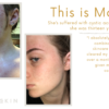 Love Skin Kiri Aroha Facial Serum - Acne / Combination Skin